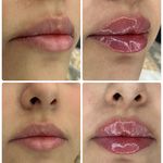 مرکز  پوست مو و زیبایی و لاغری دونادرم