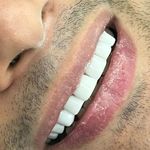 دندانپزشک تجربی مینایی