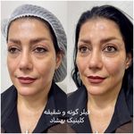 کلینیک تخصصی لیزر ،پوست و‌زیبایی بهشاد