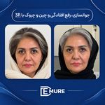 کلینیک زیبایی و جوانسازی دمور