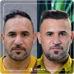 کلینیک پوست مو و زیبایی نوین ایرانا