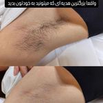 مرکز زیبایی و لیزر شادیم