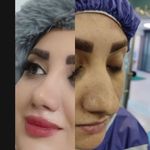 دکتر علی رضا کامیابی جراح زیبایی بینی