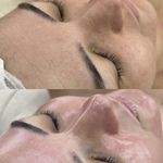 پاکسازی پوست و مو مهسام