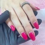 کاشت ناخن نیلا