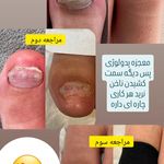 پدیکور و پدولوژیست فرزانه محمدی