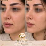 کلینیک زیبایی رز سفید (دکتر کاشانی)