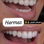 دندانپزشکی هرمس