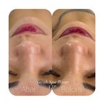مرکز ماساژ و فیشال سارا