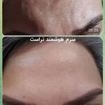 مشاوره تخصصی پوست ومولیاتیم