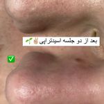 كلينيك زيبايي پوستينو