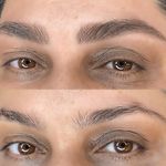 مرکز تخصصی فیبروز ابرو مژگان خناری