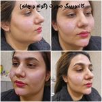 کلینیک زیبایی و لیزر مو گندم شرق تهران