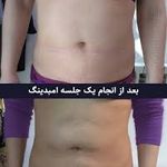 کلینیک لیزر و زیبایی مهسان