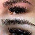 میکروبلیدینگ مینا