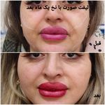 کلینیک زیبایی و لیزر مو گندم شرق تهران