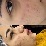 خدمات تخصصي پوست و تيرگي هاي بدن محبوبه