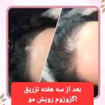 طب سنتی عامری (حجامت و بادکش)