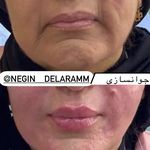 کلینیک زیبایی نگین دلارام