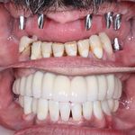 دنداپزشکی دکتر یاشار معزز