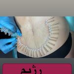 کلینیک لیزر و زیبایی مهسان