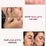 کلینیک فیشال و ماساژ سارن اسکین سارا