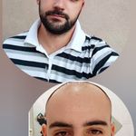 کلینیک زیبایی و کاشت مو تخصصی دستانی