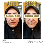 مرکز زیبایی,بوتاکس و لیزر آروشا