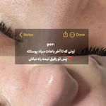 مژگان اسکین کرMojgan skincare
