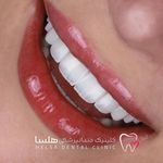 کلینیک دندانپزشکی هلسا(اقساط)
