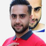 کاشت مو تبریز سونیتا