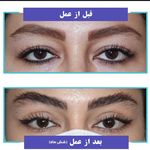 بلفاروپلاستی دکتر سیدمحمدرضا حسینی