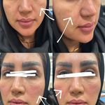 کلینیک ژل بوتاکس لیزر فیل بیوتی