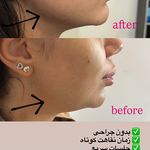 مرکز لیزر و کلینیک زیبایی پریفا