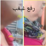کلینیک لیزر زیبایی و درمانی دکتر راجی‌فر