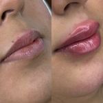 کلینیک تخصصی زیبایی و لیزر ویان