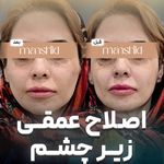 کلینیک زیبایی مانشید