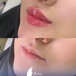 کلینیک زیبایی و لیزر سلن مشهد