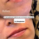 دکتر علی مقدمی (پزشک پوست مو زیبایی)