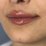 کلینیک زیبایی دکتر لیلا رحیمی