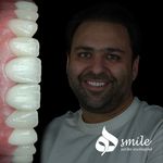 دندانپزشکی دیجیتال دکتر مهدی کثیری