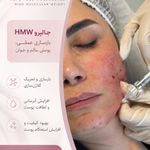 مرکز لیزر ،پوست و زیبایی کندی بیوتی