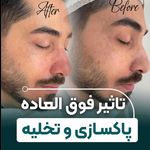 کلینیک فیشال و ماساژ سارن اسکین سارا