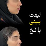 کلینیک زیبایی و جوانسازی پوست و مو الین