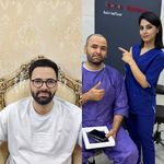 کاشت مو -کاشت ابرو -کاشت ریش شکیبا