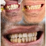 دندانپزشکی دکتر مریم فغانی(بدون بیمه)