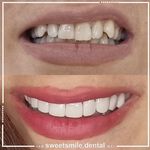 مطب دندان پزشکی لبخند شیرین