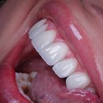 کلینیک‌دندانپزشکی دنتال آرنا-بیمه نیستیم