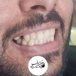 کلینیک دندان پزشکی و ایمپلنت الیسو