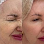 کلینیک پوست و زیبایی ژیلاوَش